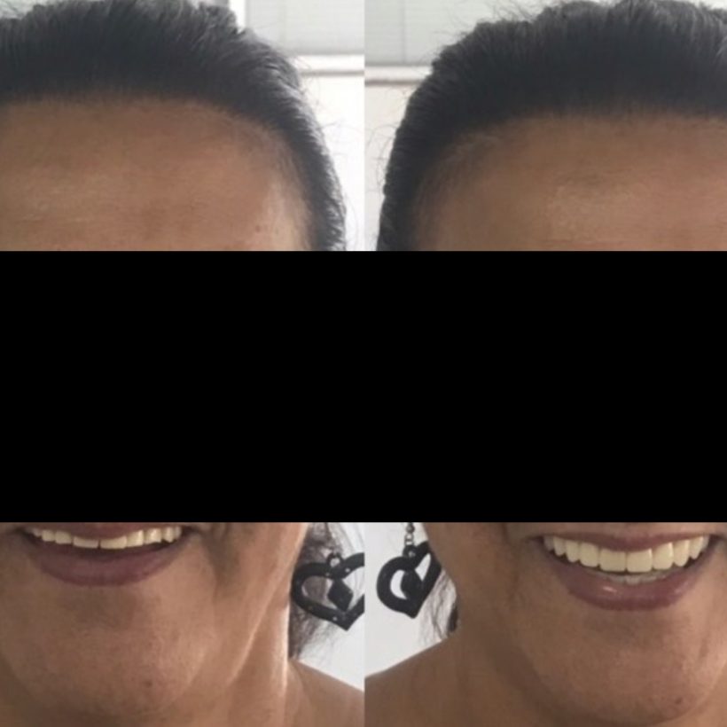 Foto Tratamento- Prótese-02(1)