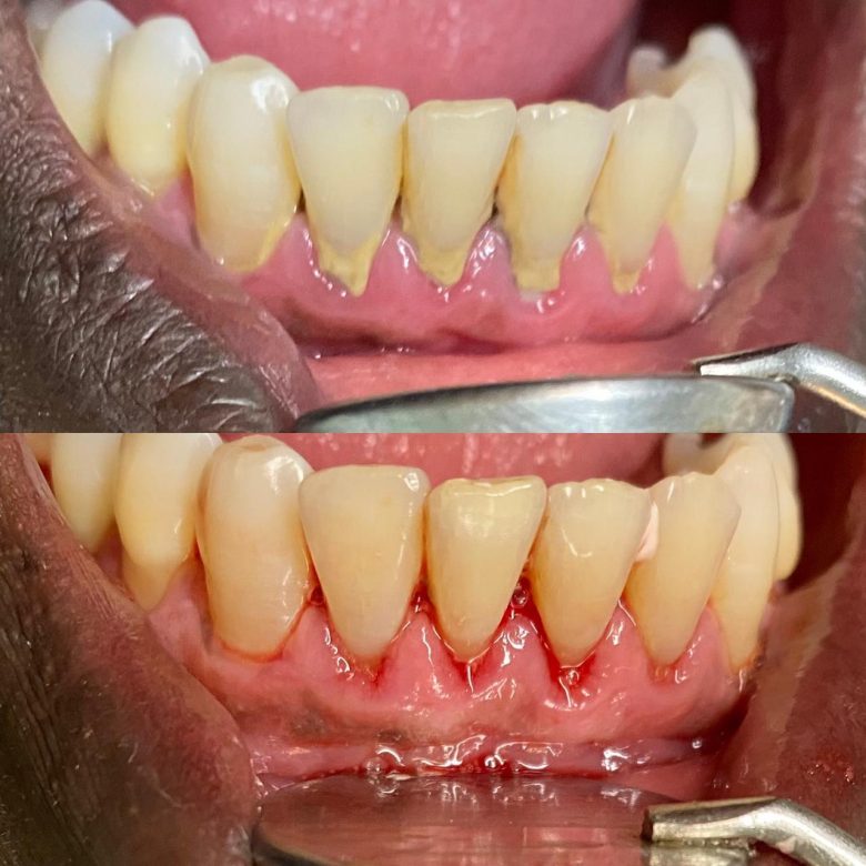 Periodontia 02